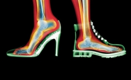 کفش پاشنه‌بلند سبب شست کج پا می‌شود